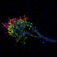 Cône de croissance d'un neurone un culture primaire - M confocale - GX=X2500