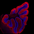 Coupe de cervelet de souris, cellules de Purkinje ( rouge) et noyaux (bleu) - M confocale - G=X15