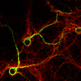 Neurones (vert) et astrocytes (rouge) en culture primaire - M confocale- G=X500
