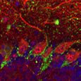 Cellules de Purkinje (rouge) et cellules et fibres GABAergiques (vert) dans une tranche aigüe de cervelet - M confocale - G=X400