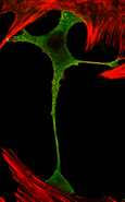 Cellule chromaffine(vert)en culture primaire entourée de fibroblastes (rouge) - M confocale - G=X750