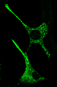 Granules de sécrétion dans des cellules chromaffines - M confocale - G=X1000