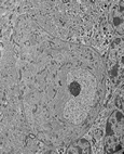 Cellule de Purkinje dans une coupe de cervelet de souris  en MET G=X6000