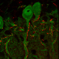 Synapses de fibres grimpantes(rouge) sur des cellules de Purkinje(vert)- M confocale-G=X500